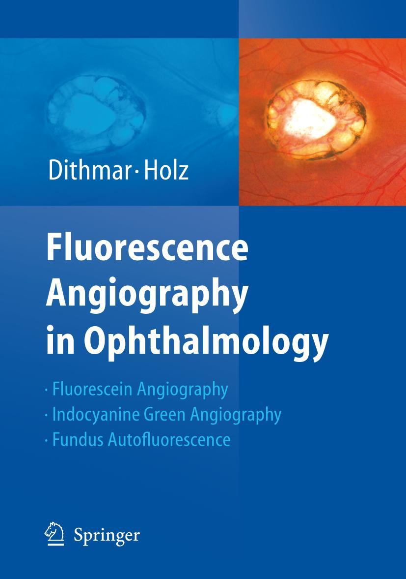 Vorderes Coverbild Fluorescence Angiography in Ophthalmology