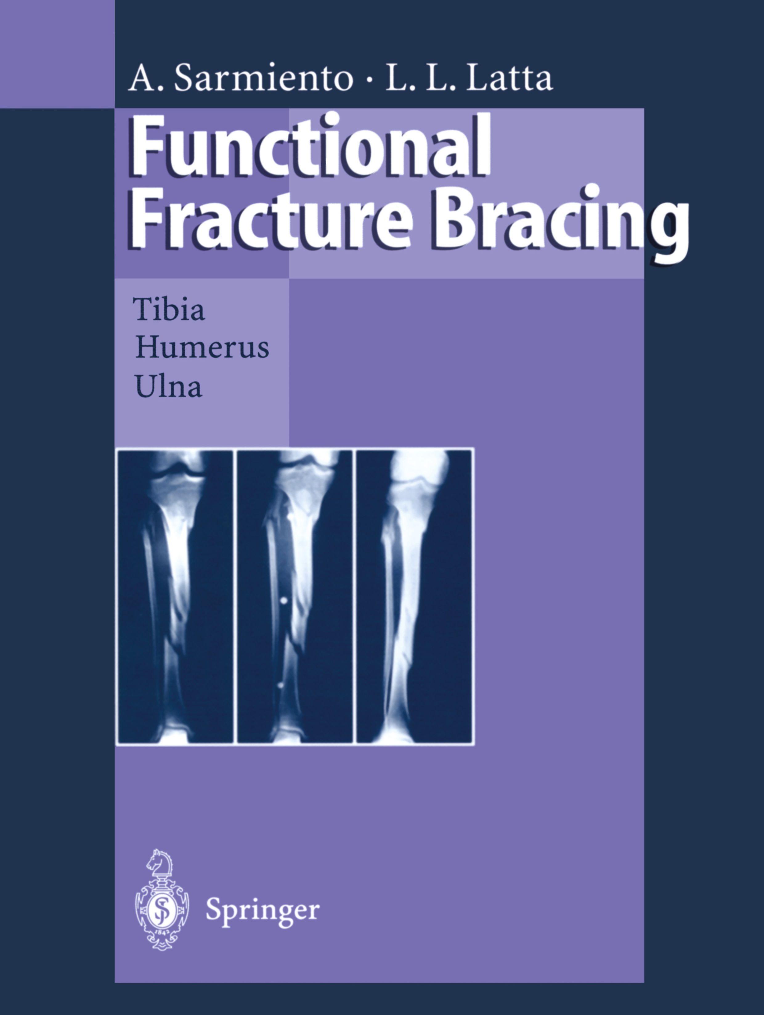 Vorderes Coverbild Functional Fracture Bracing