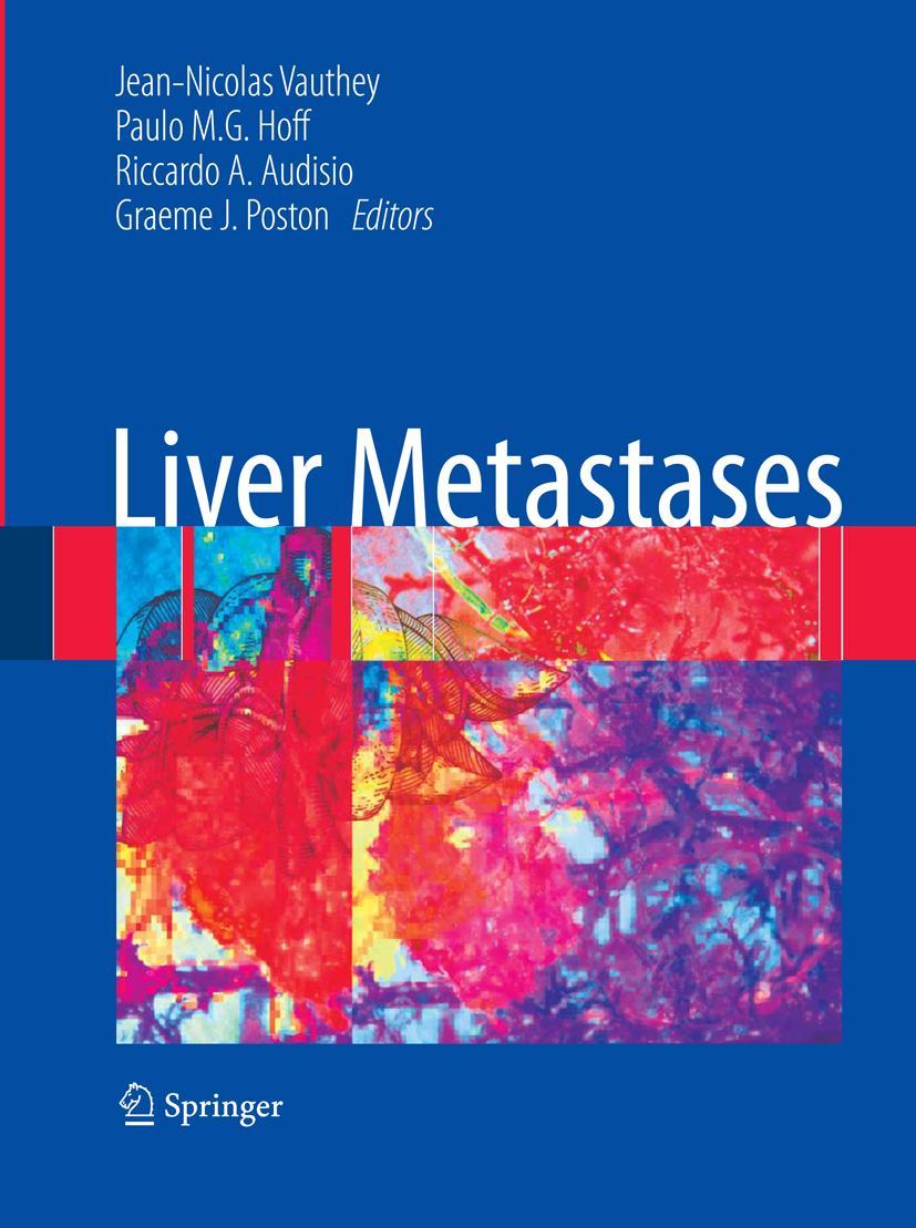 Vorderes Coverbild Liver Metastases