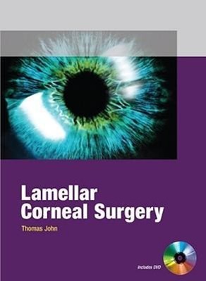 Vorderes Coverbild Lamellar Corneal Surgery