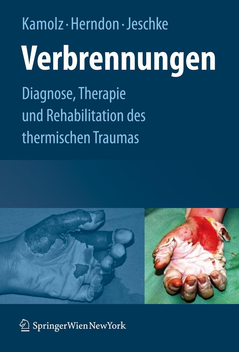 Vorderes Coverbild Verbrennungen