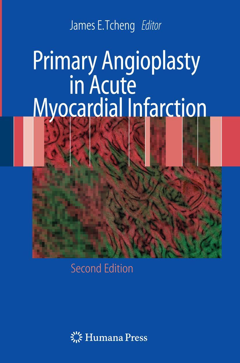 Vorderes Coverbild Primary Angioplasty in Acute Myocardial Infarction