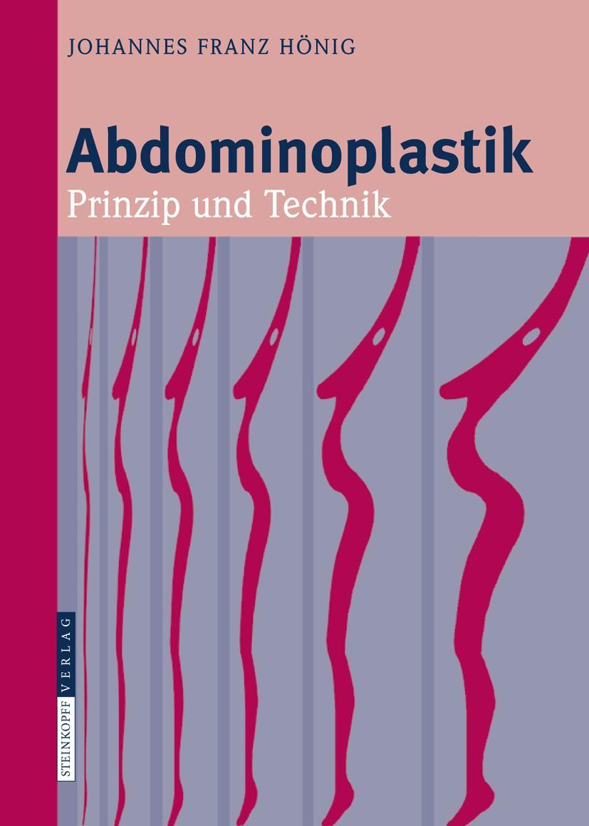 Vorderes Coverbild Abdominoplastik