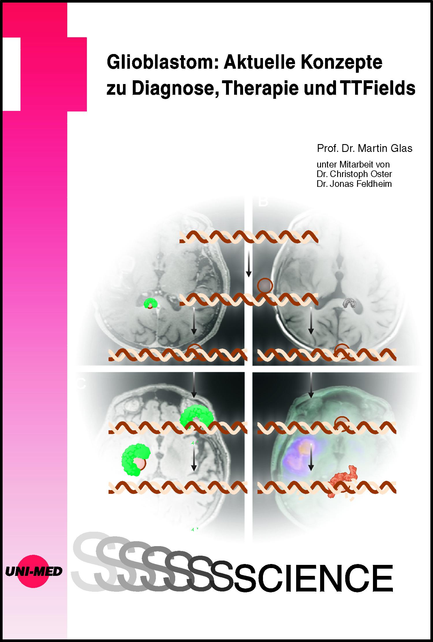 Vorderes Coverbild Glioblastom: Aktuelle Konzepte zu Diagnose, Therapie und TTFields