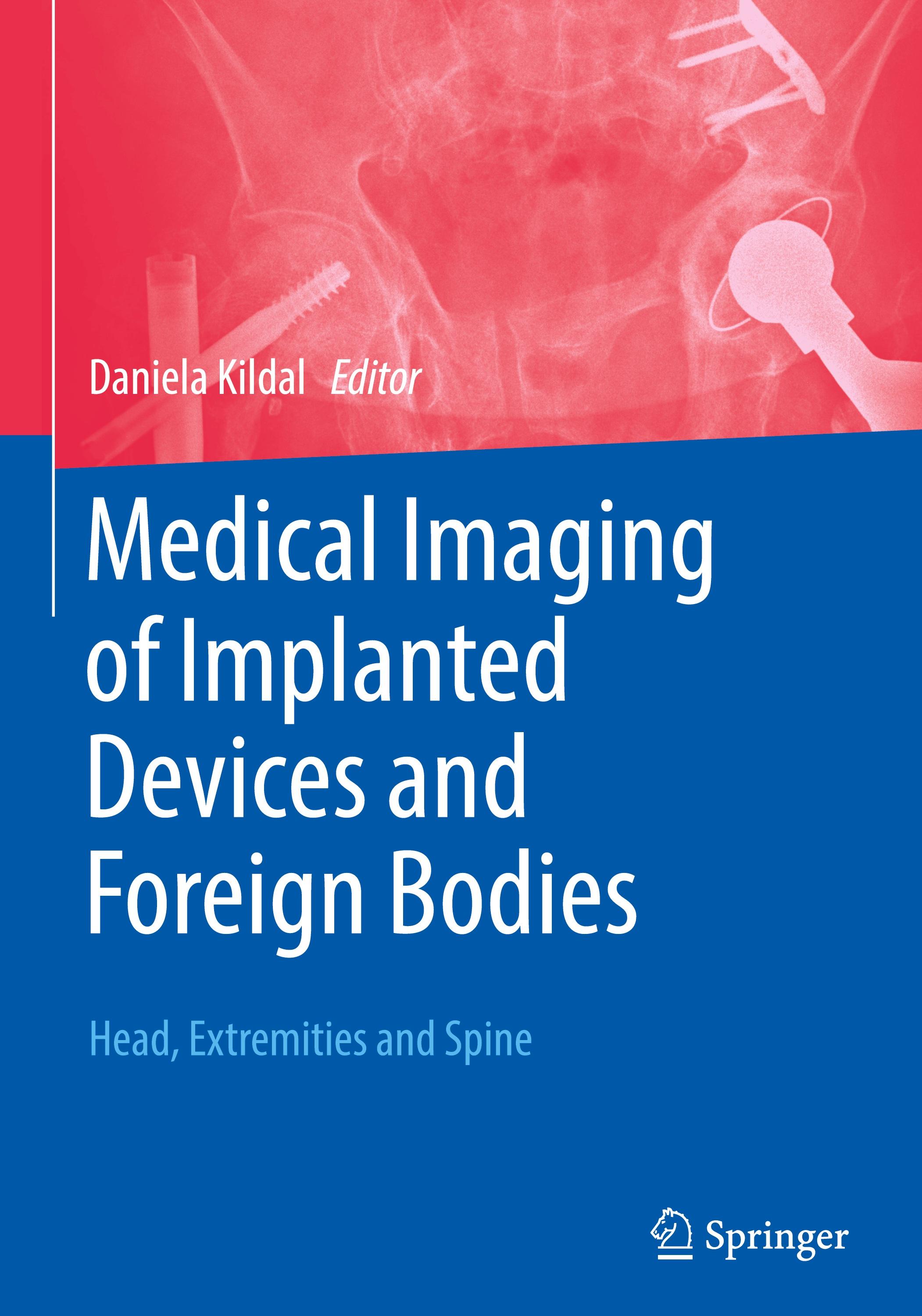 Vorderes Coverbild Medical Imaging of Implanted Devices and Foreign Bodies