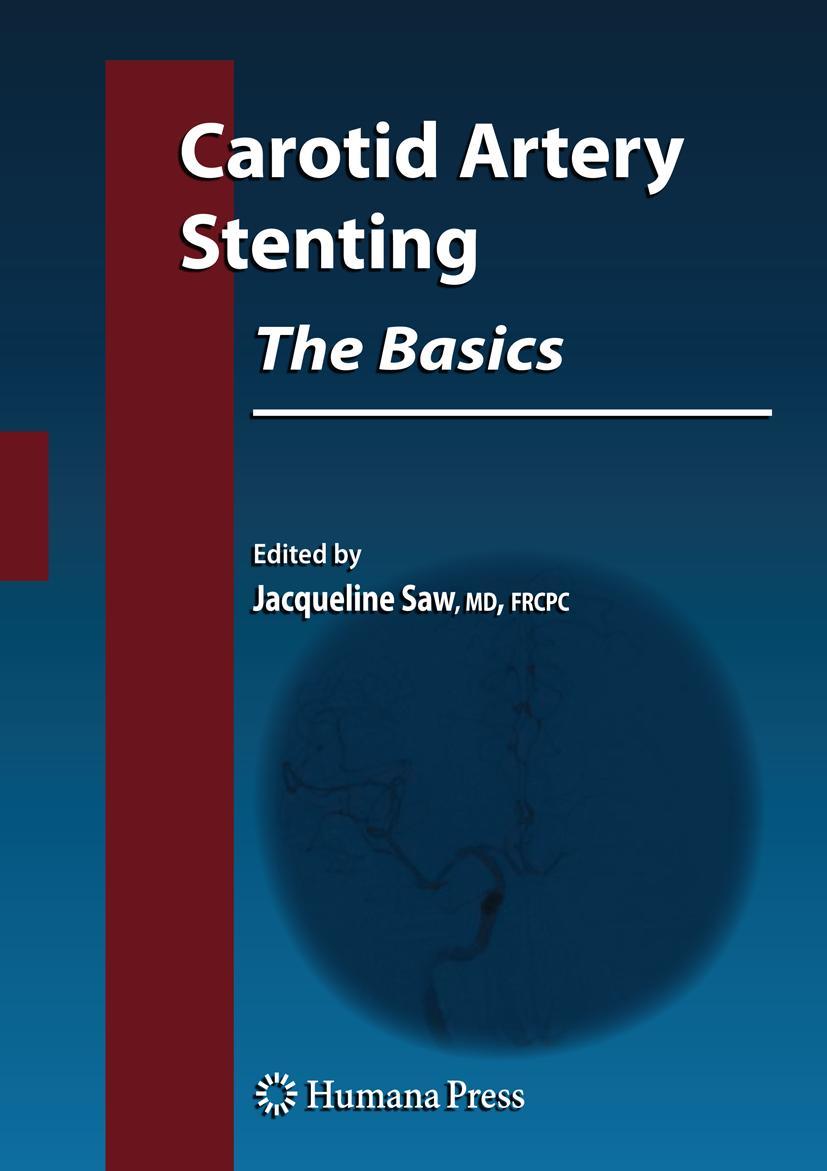 Vorderes Coverbild Carotid Artery Stenting: The Basics
