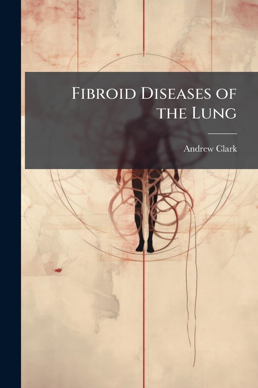 Vorderes Coverbild Fibroid Diseases of the Lung