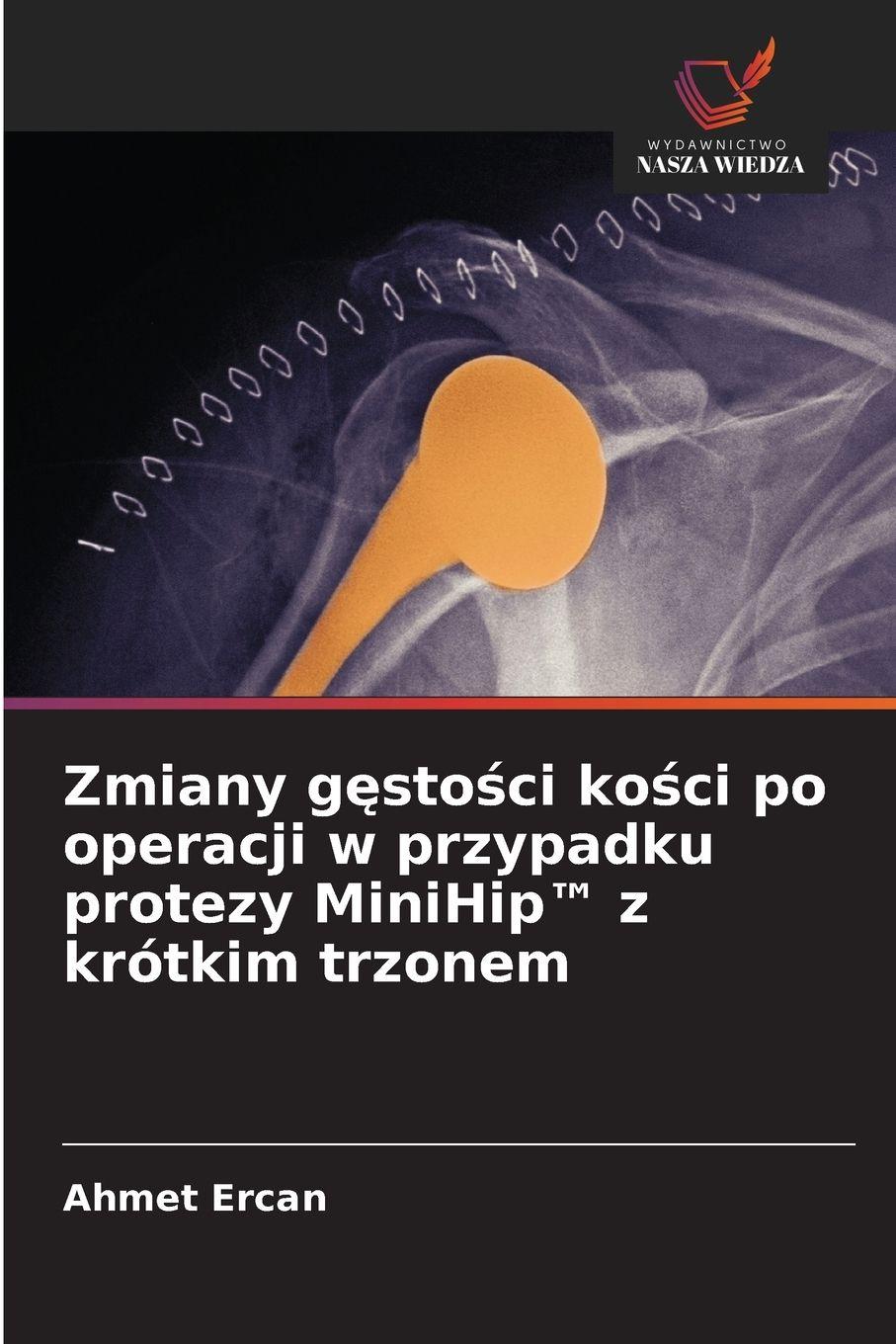 Vorderes Coverbild Zmiany g¿sto¿ci ko¿ci po operacji w przypadku protezy MiniHip(TM) z krótkim trzonem