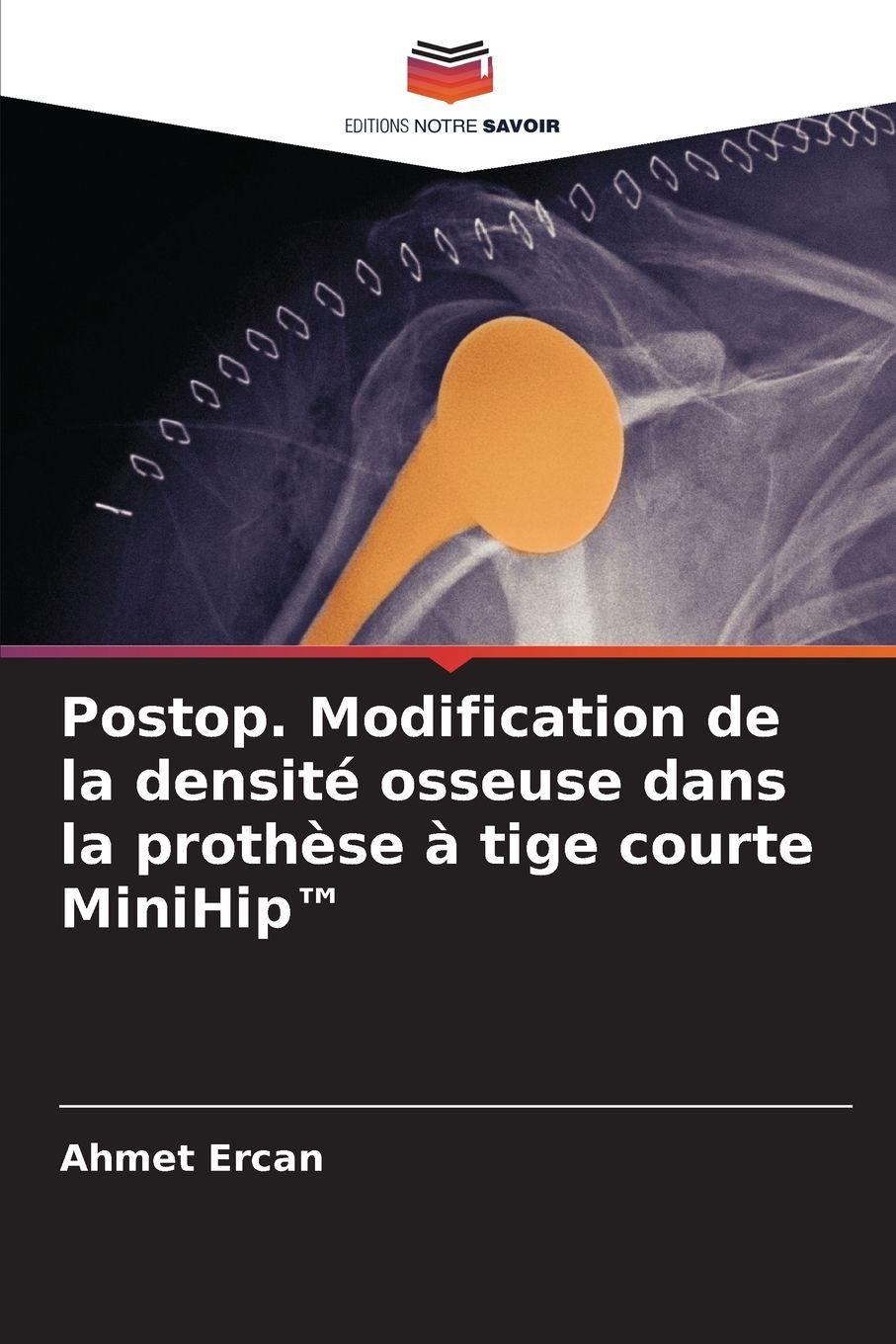 Vorderes Coverbild Postop. Modification de la densité osseuse dans la prothèse à tige courte MiniHip(TM)