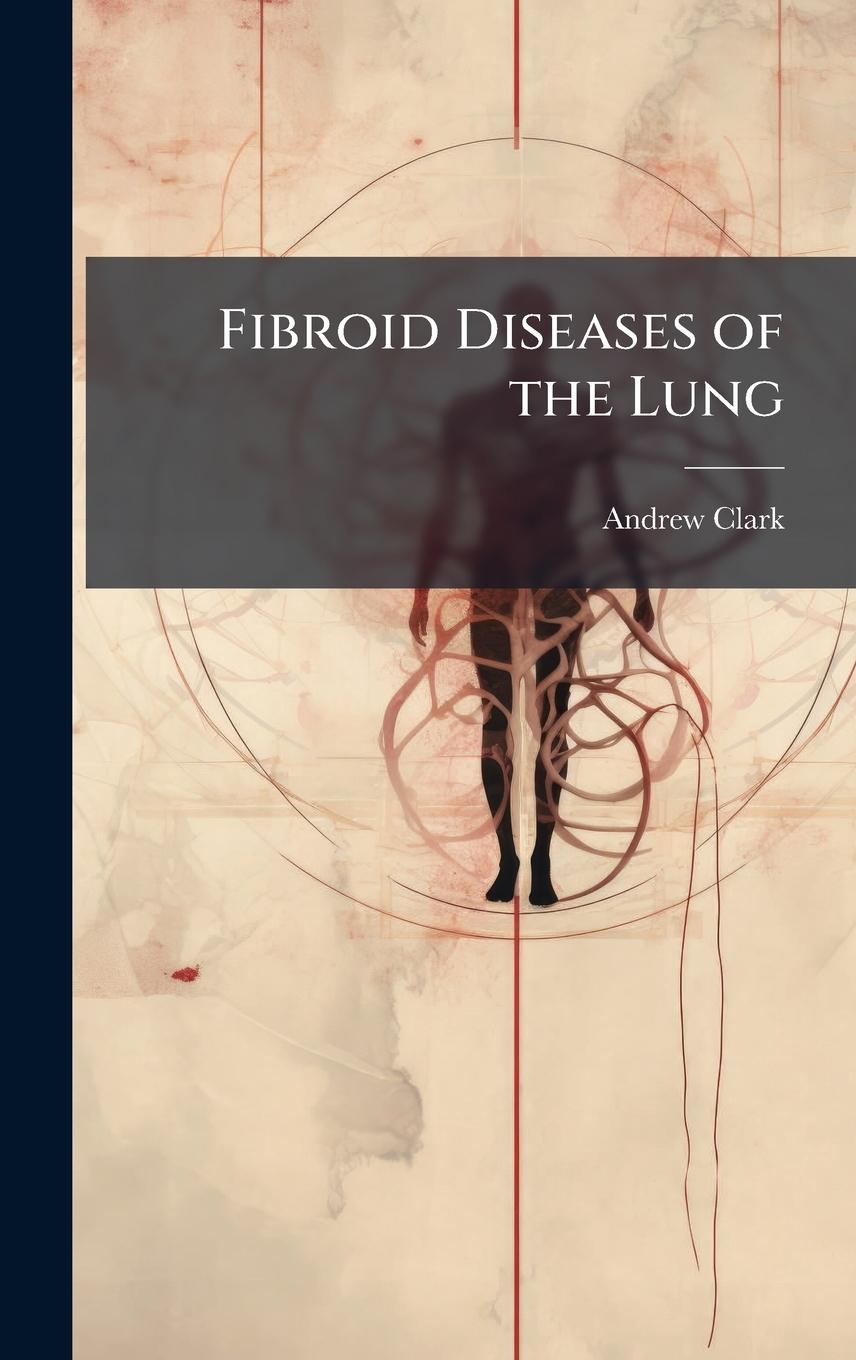 Vorderes Coverbild Fibroid Diseases of the Lung