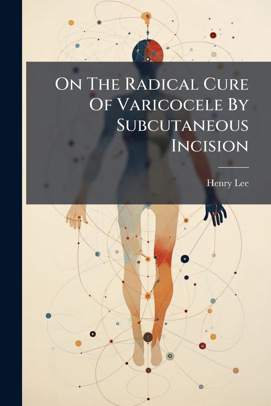 Vorderes Coverbild On The Radical Cure Of Varicocele By Subcutaneous Incision