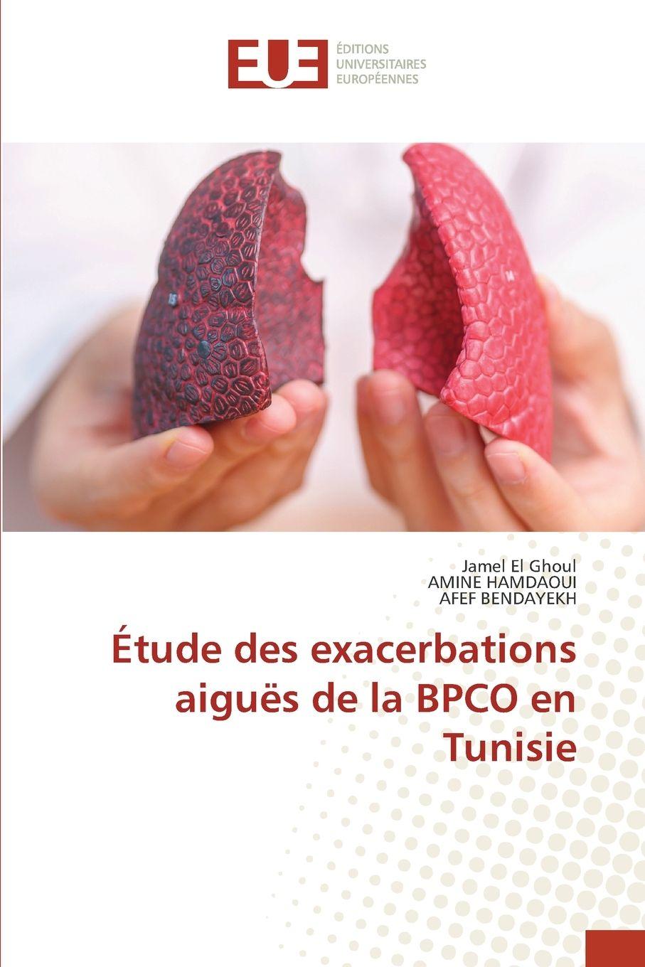 Vorderes Coverbild Étude des exacerbations aiguës de la BPCO en Tunisie