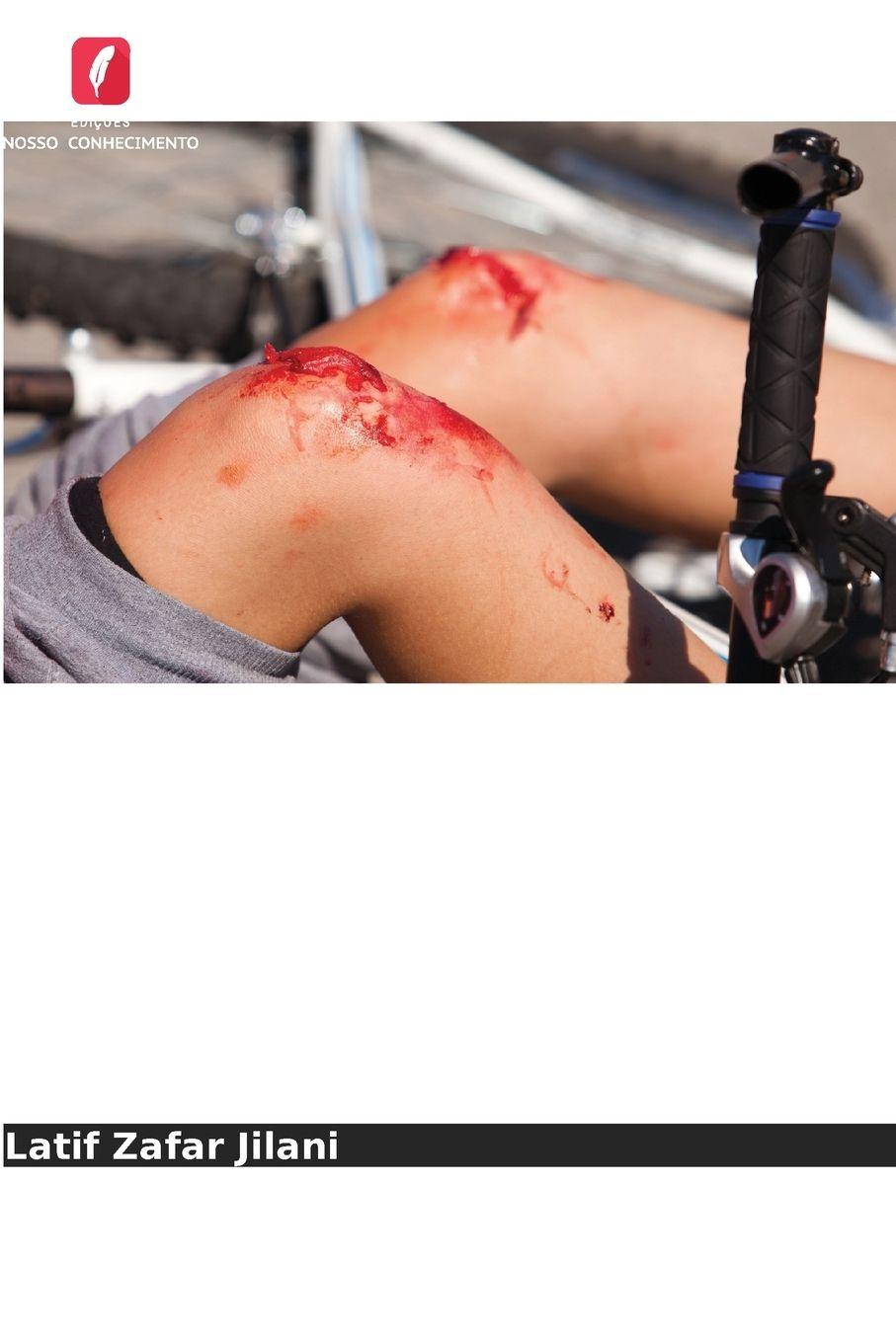 Vorderes Coverbild Lesões negligenciadas e seu tratamento