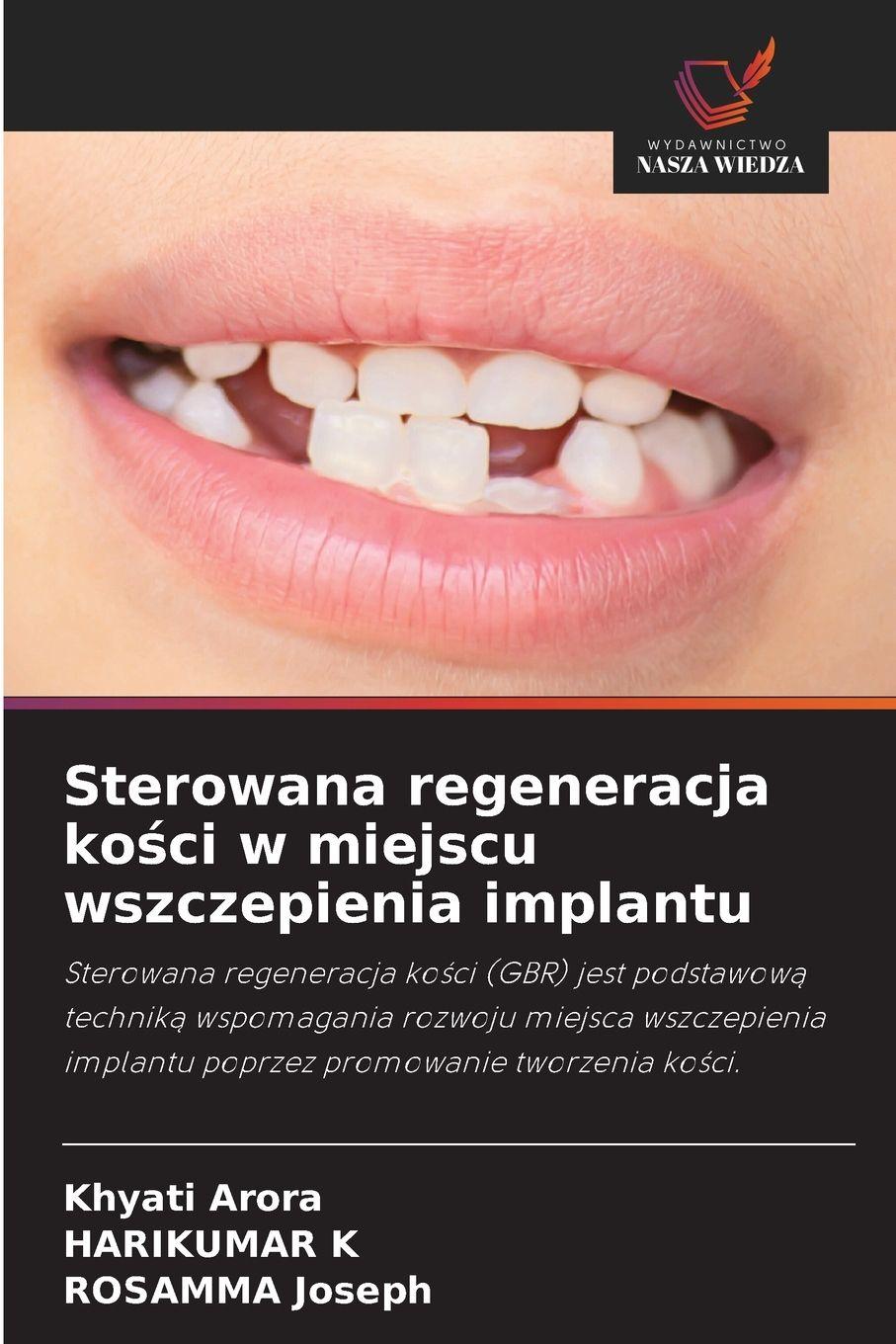 Vorderes Coverbild Sterowana regeneracja ko¿ci w miejscu wszczepienia implantu