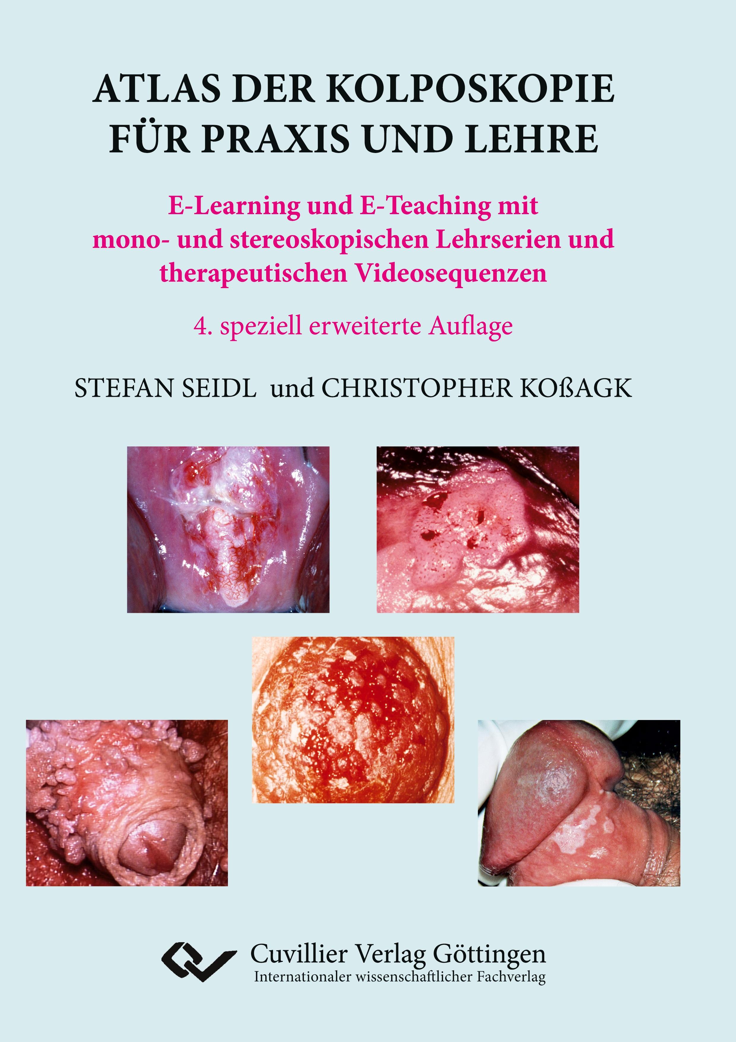 Vorderes Coverbild Atlas der Kolposkopie für Praxis und Lehre. E-Learning und E-Teaching mit mono- und stereoskopischen Lehrserien und therapeutischen Videosequenzen