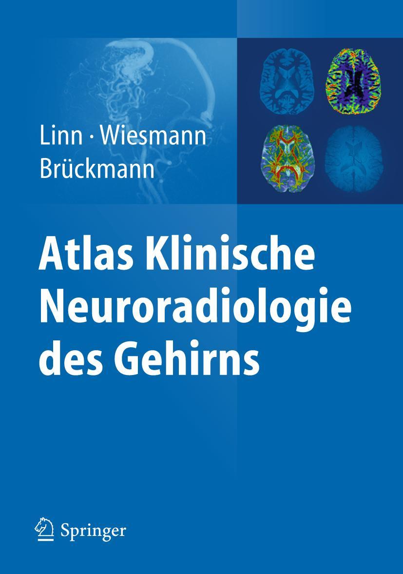 Vorderes Coverbild Atlas Klinische Neuroradiologie des Gehirns