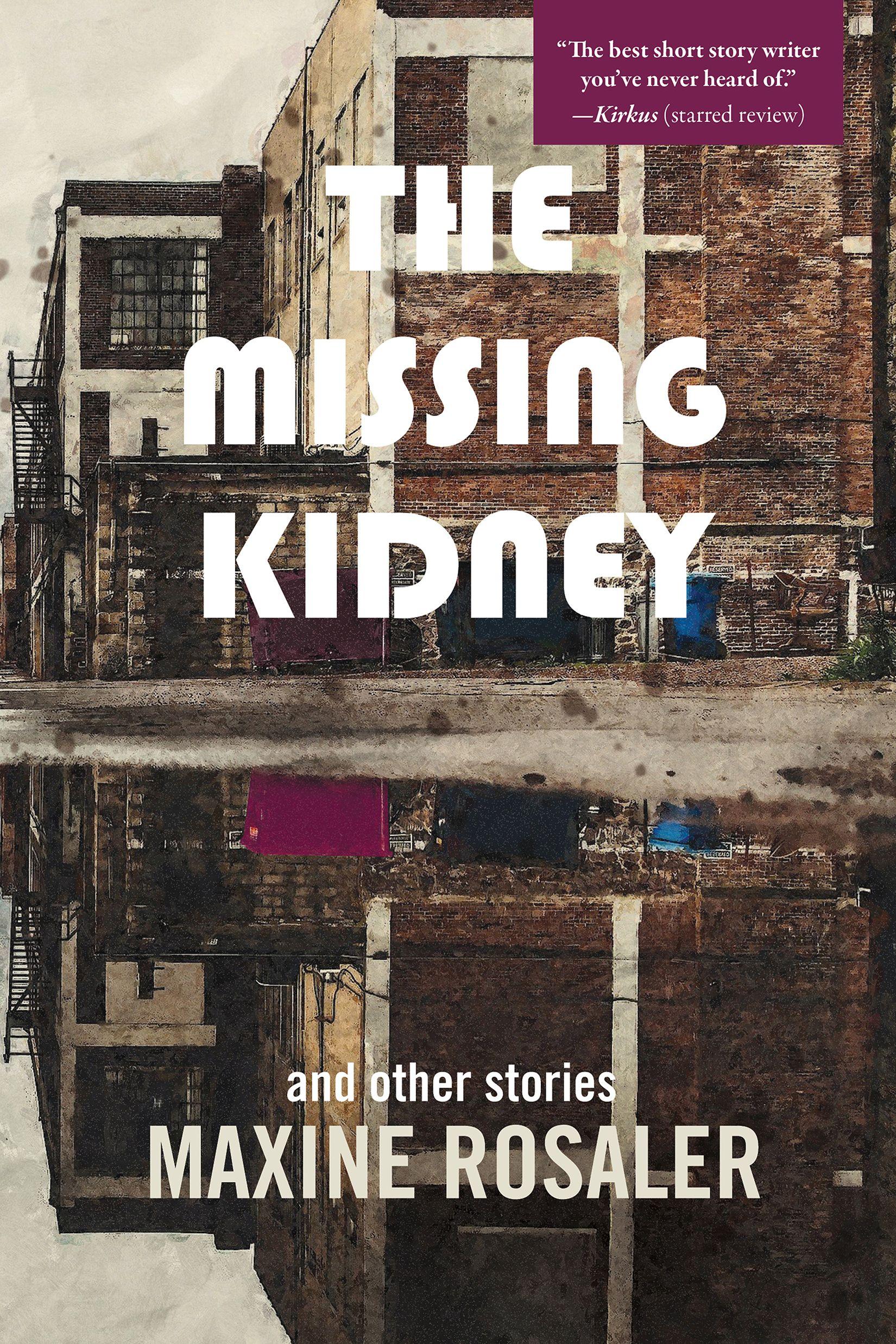 Vorderes Coverbild The Missing Kidney and Other Stories