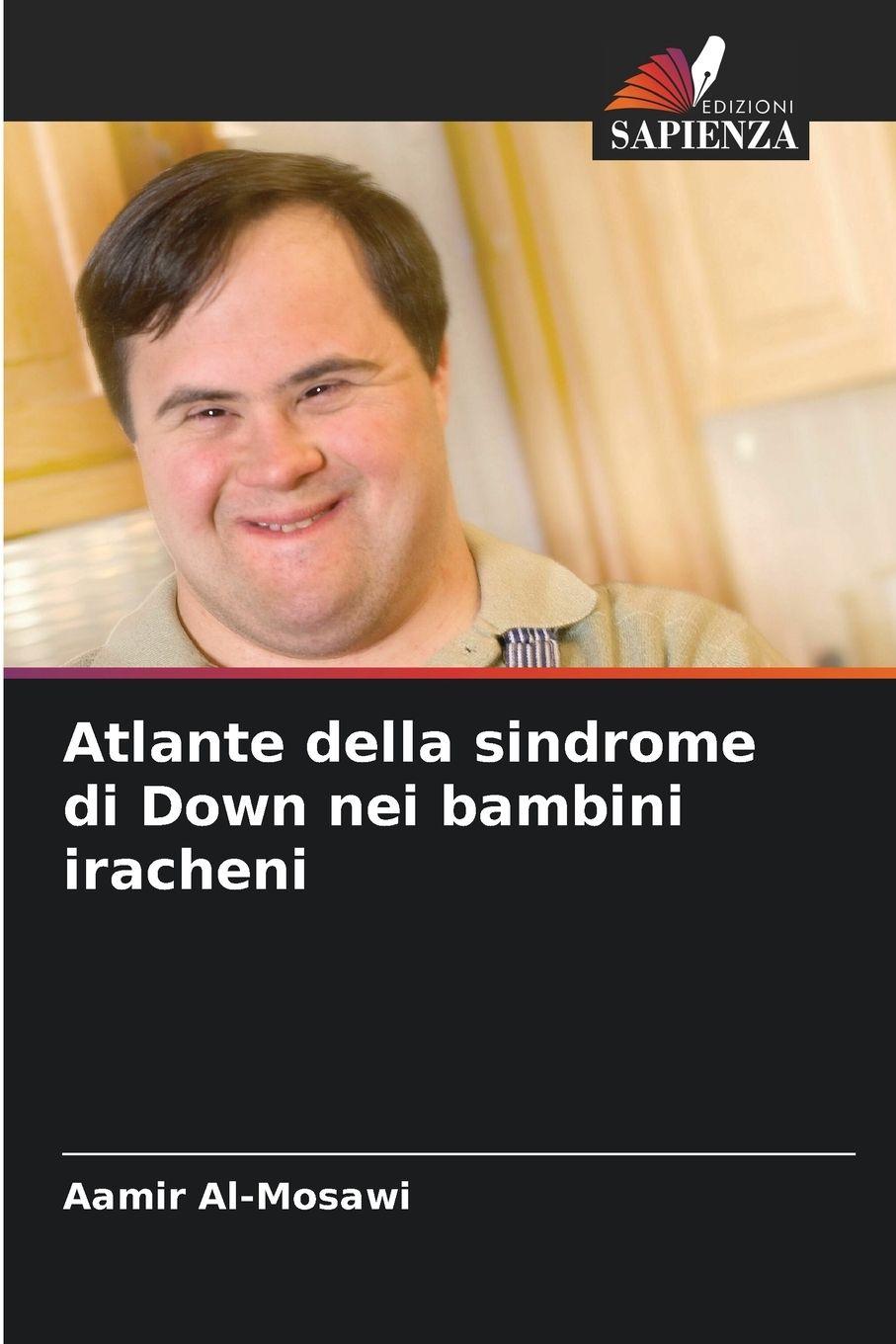 Vorderes Coverbild Atlante della sindrome di Down nei bambini iracheni