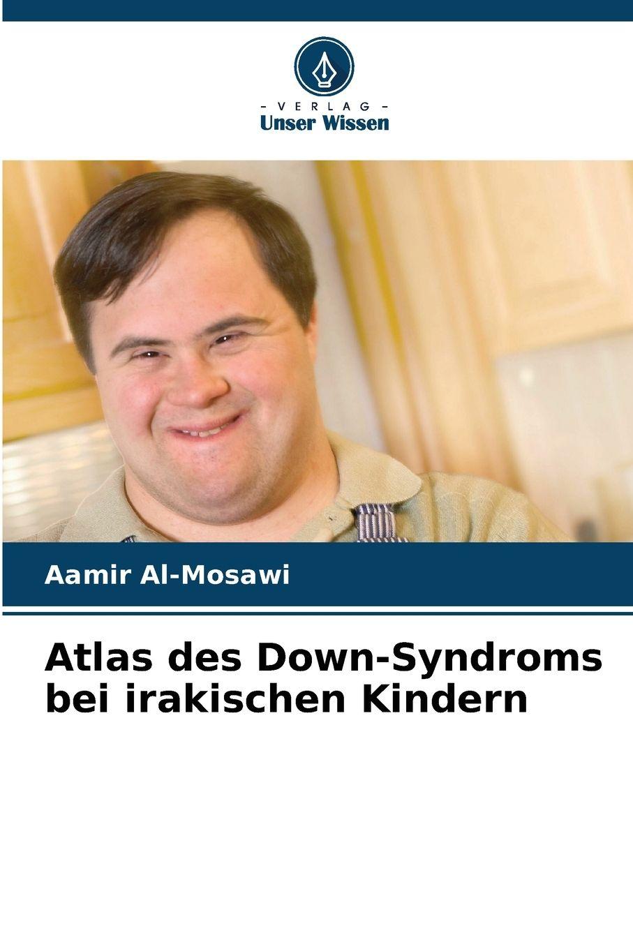 Vorderes Coverbild Atlas des Down-Syndroms bei irakischen Kindern