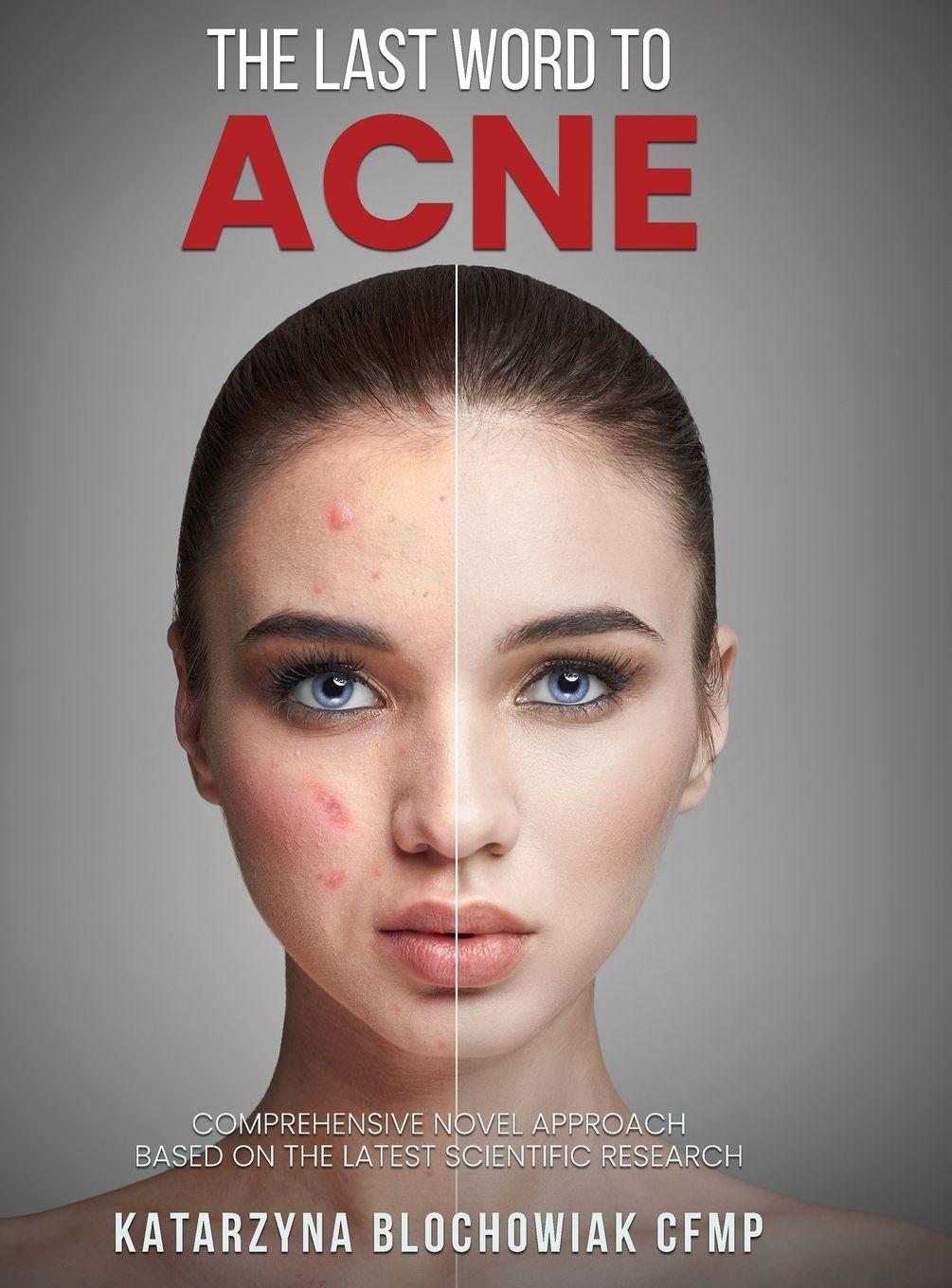 Vorderes Coverbild The Last Word To Acne