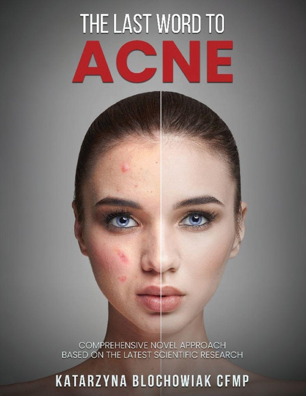 Vorderes Coverbild The Last Word To Acne