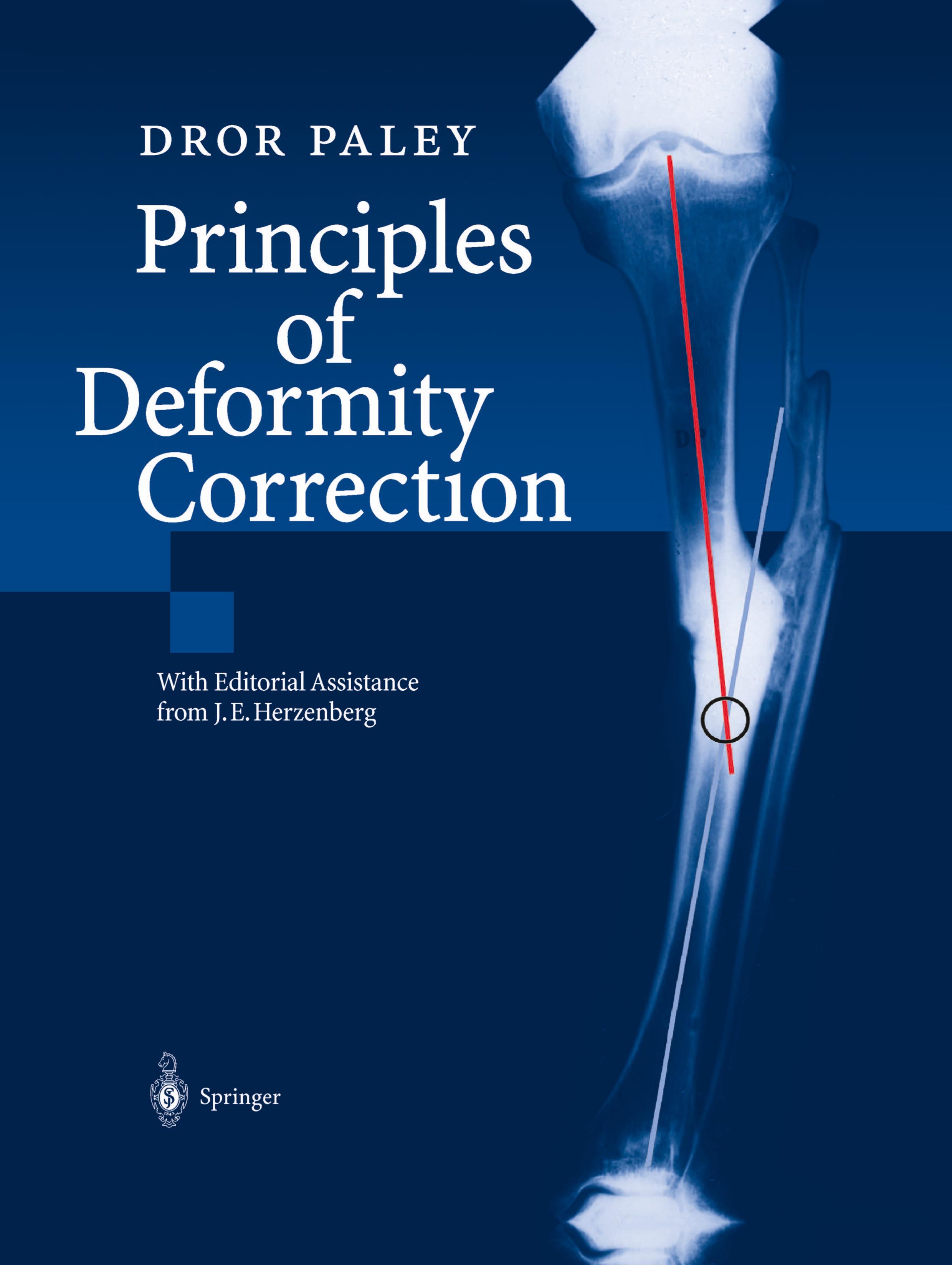 Vorderes Coverbild Principles of Deformity Correction