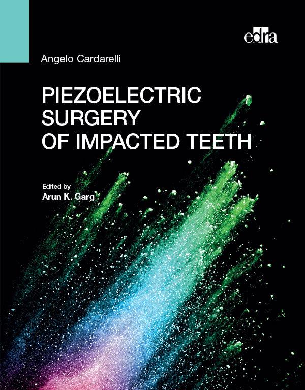 Vorderes Coverbild Piezoelectric Surgery of Impacted Teeth