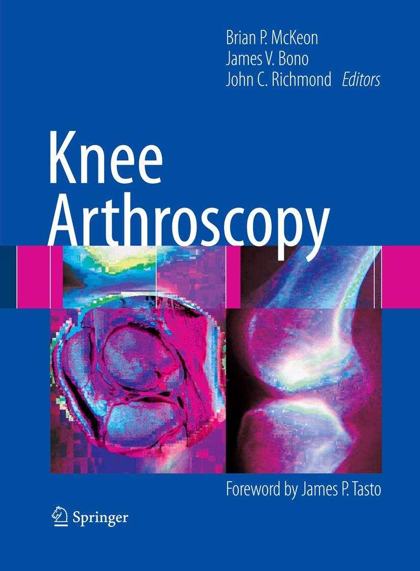 Vorderes Coverbild Knee Arthroscopy