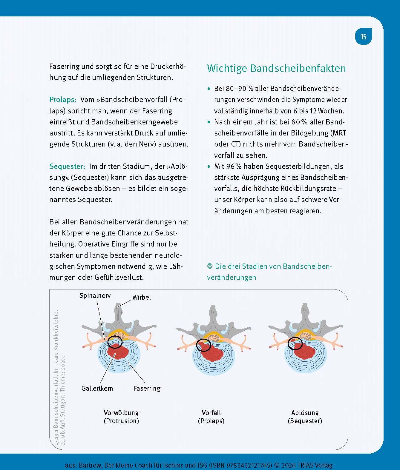 Beispielinhalt (Bild) Der kleine Coach für Ischias und ISG