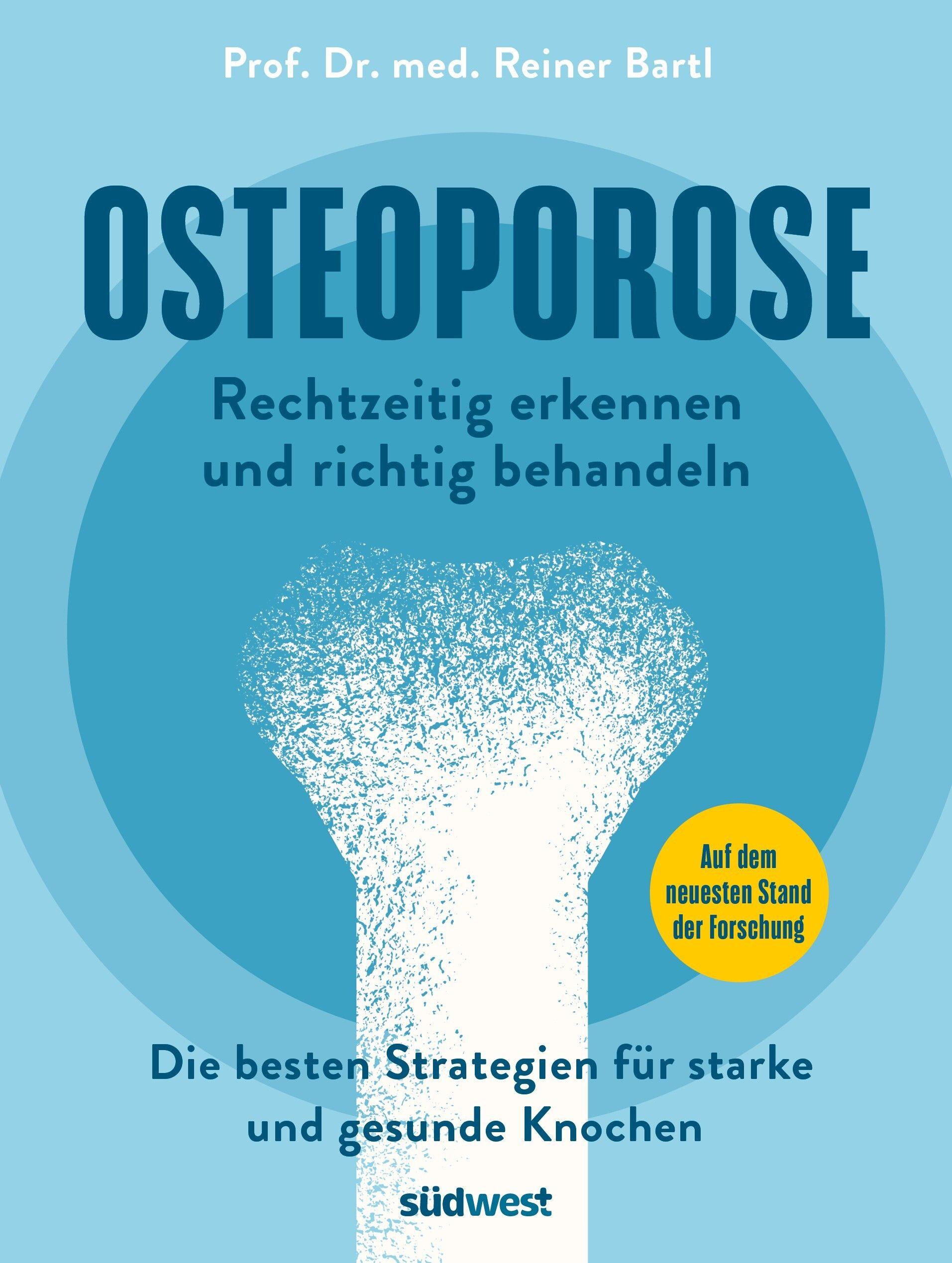 Vorderes Coverbild Osteoporose rechtzeitig erkennen und behandeln