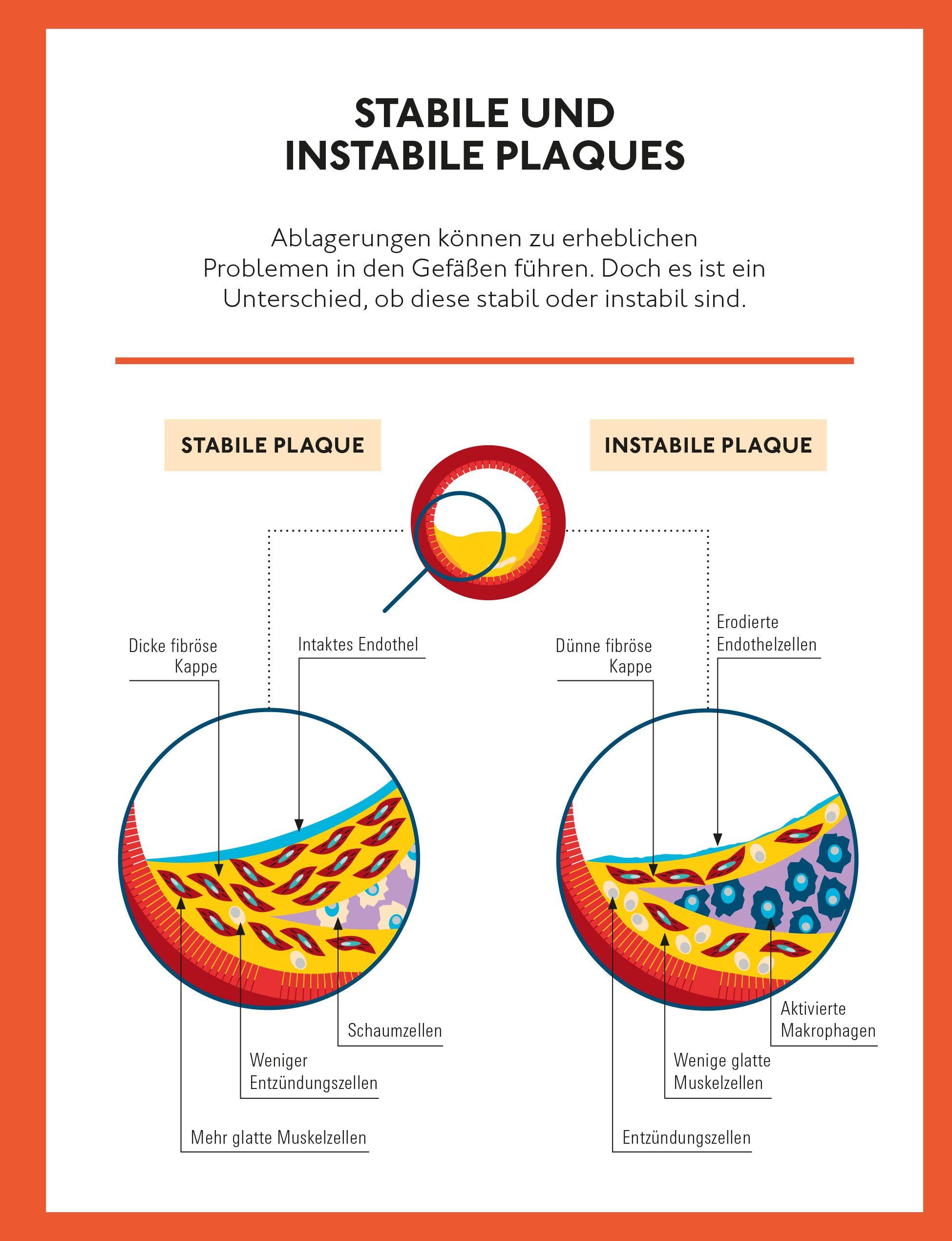 Beispielinhalt (Bild) Runter mit dem Cholesterin