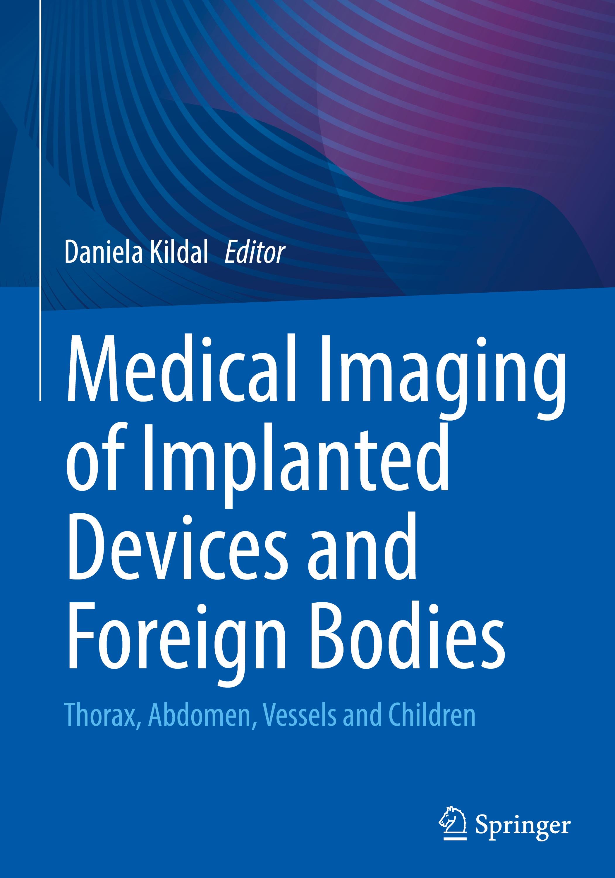 Vorderes Coverbild Medical Imaging of Implanted Devices and Foreign Bodies