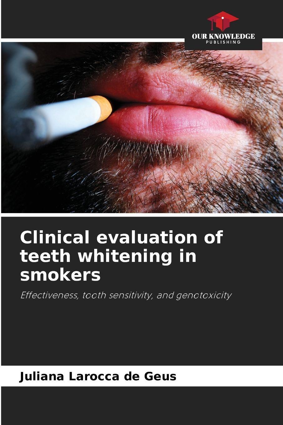 Vorderes Coverbild Clinical evaluation of teeth whitening in smokers