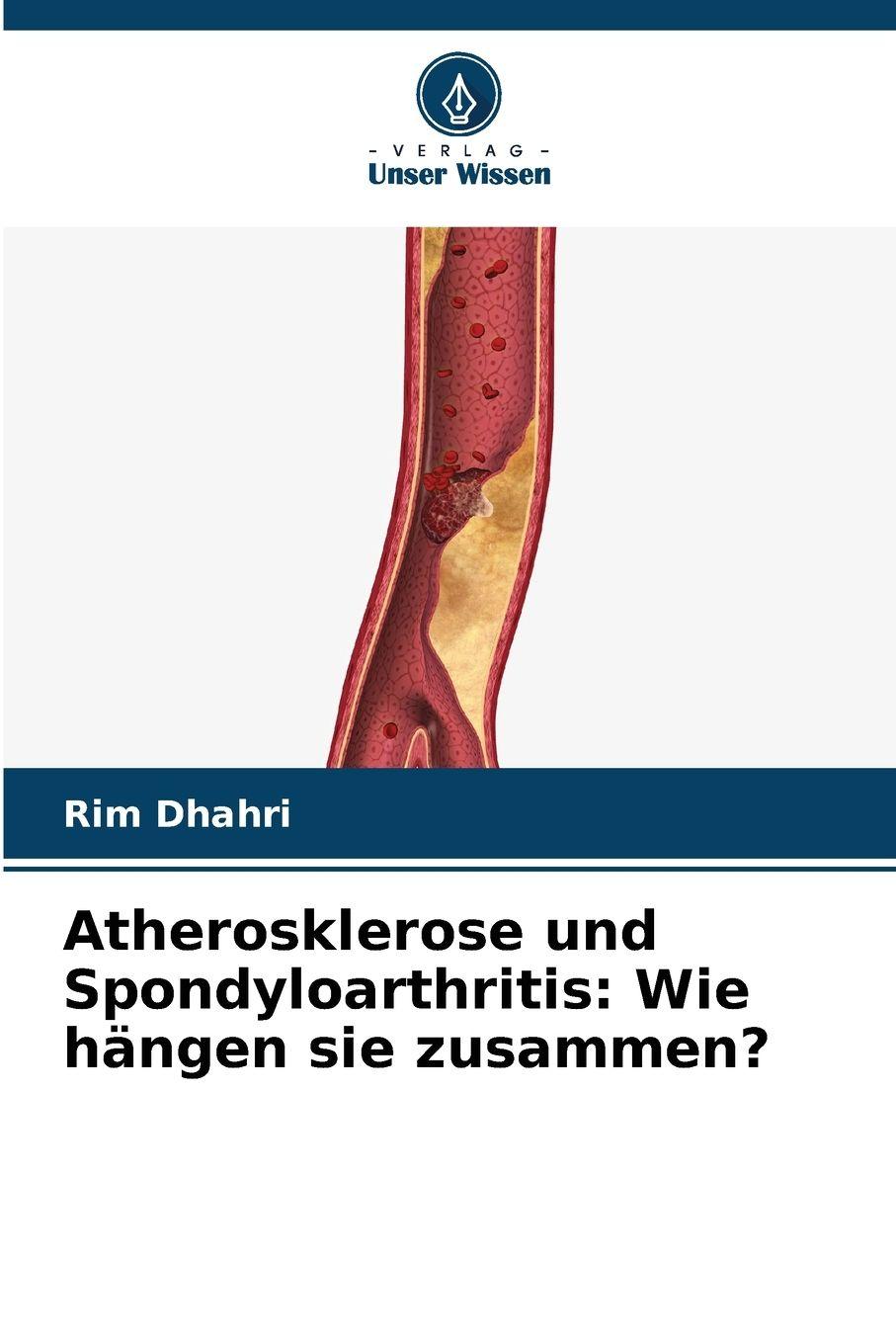 Vorderes Coverbild Atherosklerose und Spondyloarthritis: Wie hängen sie zusammen?