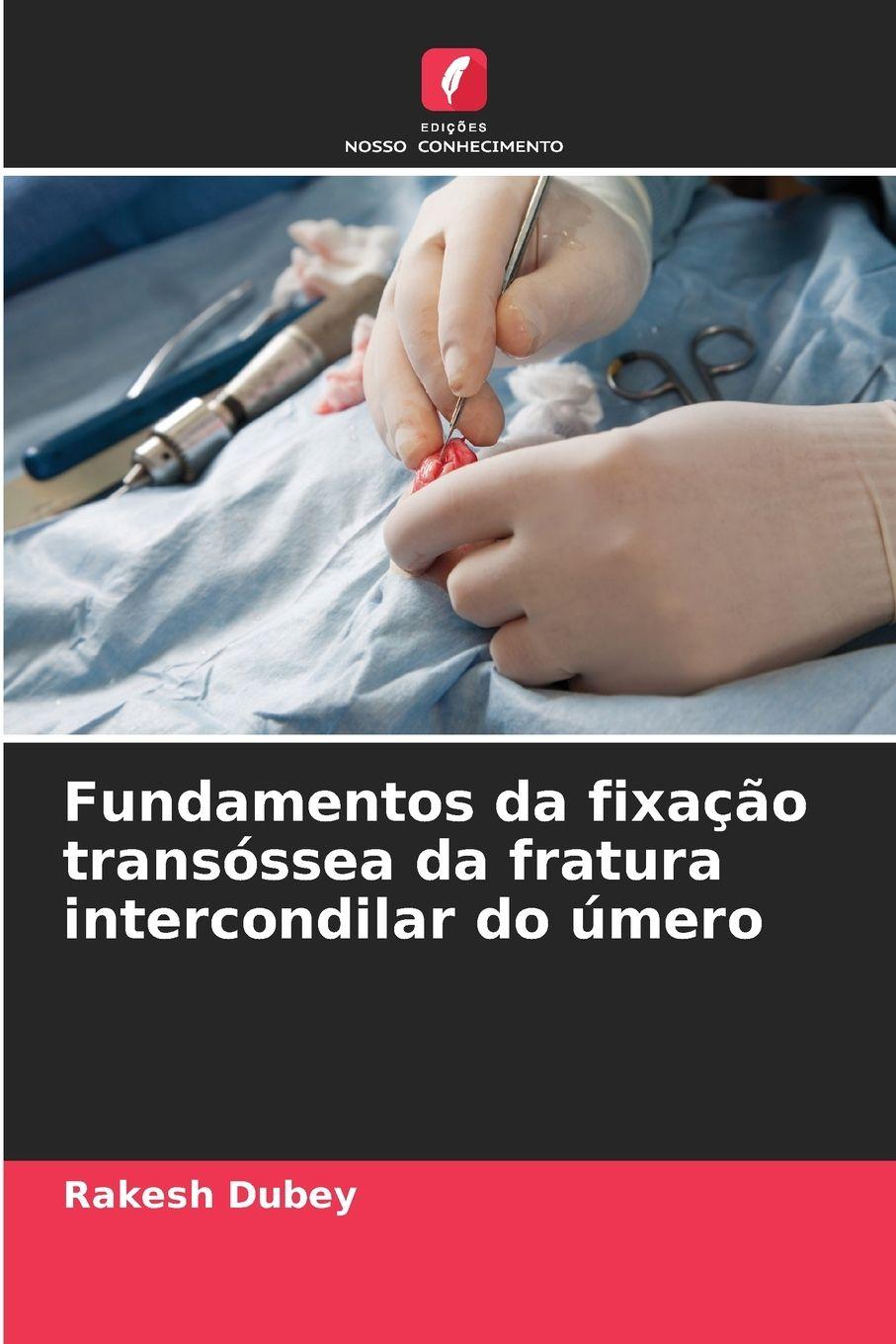 Vorderes Coverbild Fundamentos da fixação transóssea da fratura intercondilar do úmero