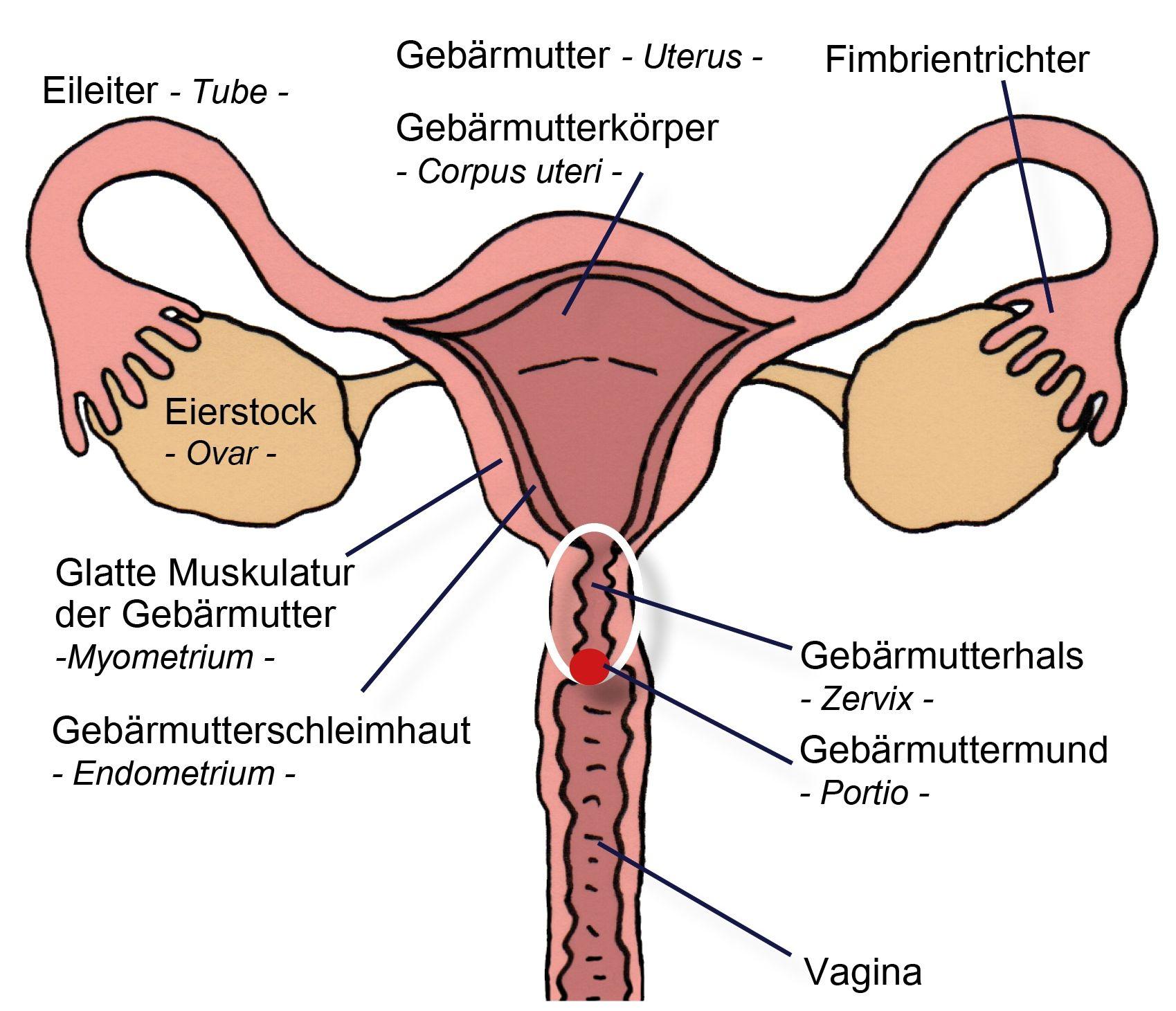 Beispielinhalt (Bild) Myome gebärmuttererhaltend behandeln
