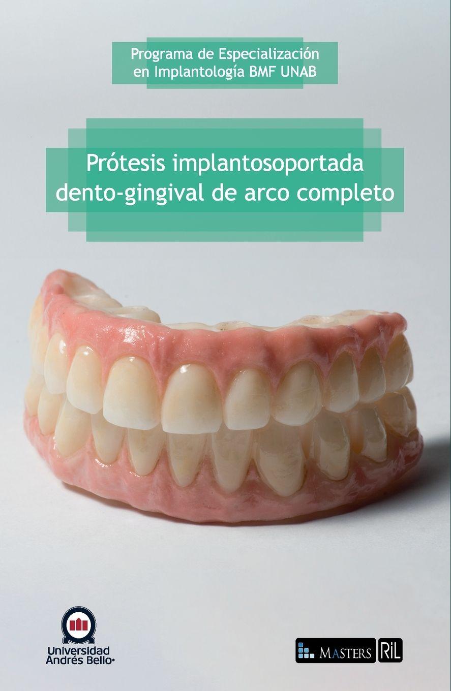 Vorderes Coverbild Prótesis implantosoportada dento-gingival de arco completo