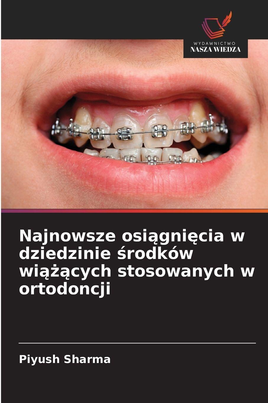 Vorderes Coverbild Najnowsze osi¿gni¿cia w dziedzinie ¿rodków wi¿¿¿cych stosowanych w ortodoncji