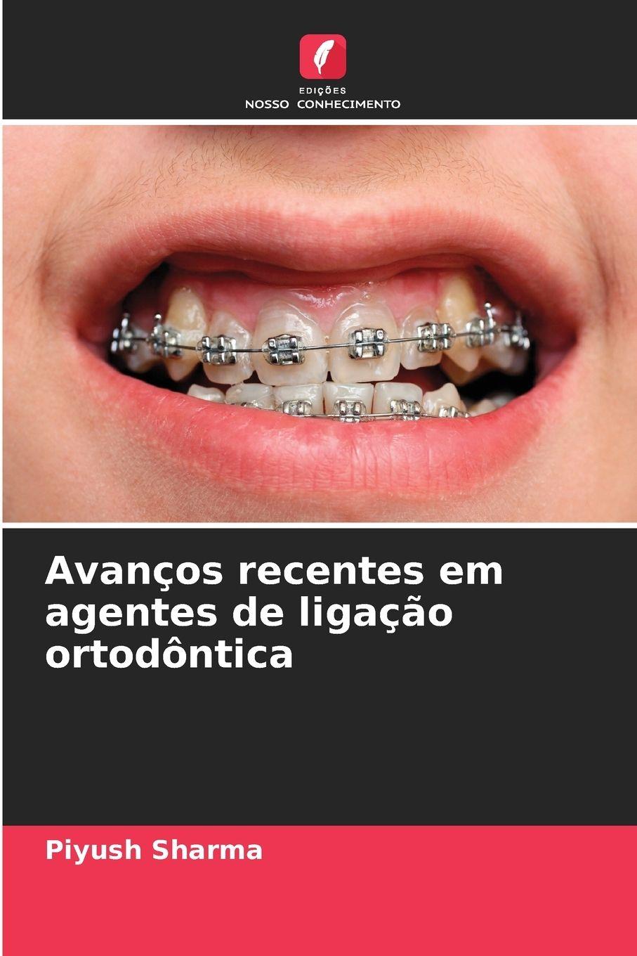 Vorderes Coverbild Avanços recentes em agentes de ligação ortodôntica