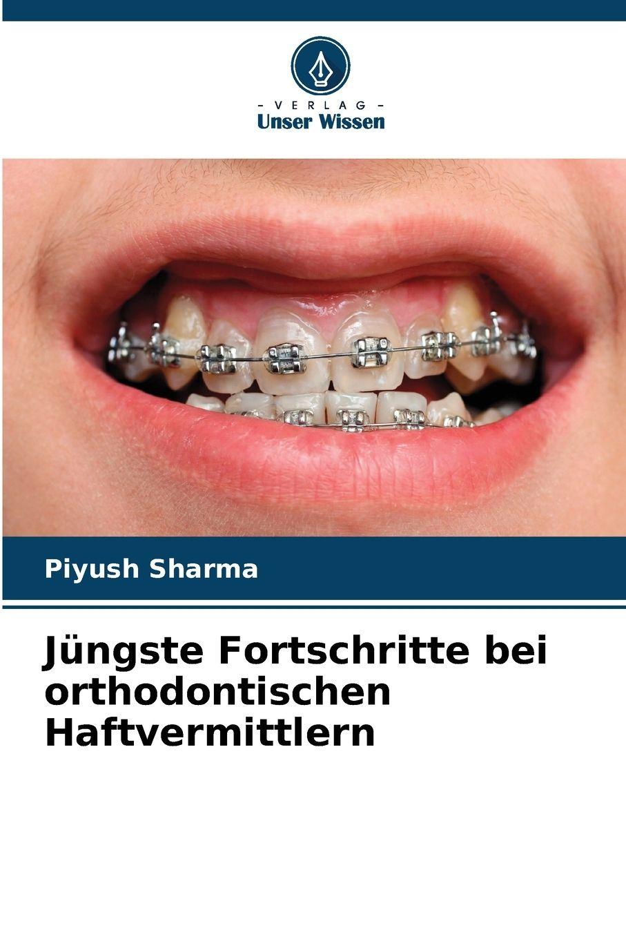 Vorderes Coverbild Jüngste Fortschritte bei orthodontischen Haftvermittlern