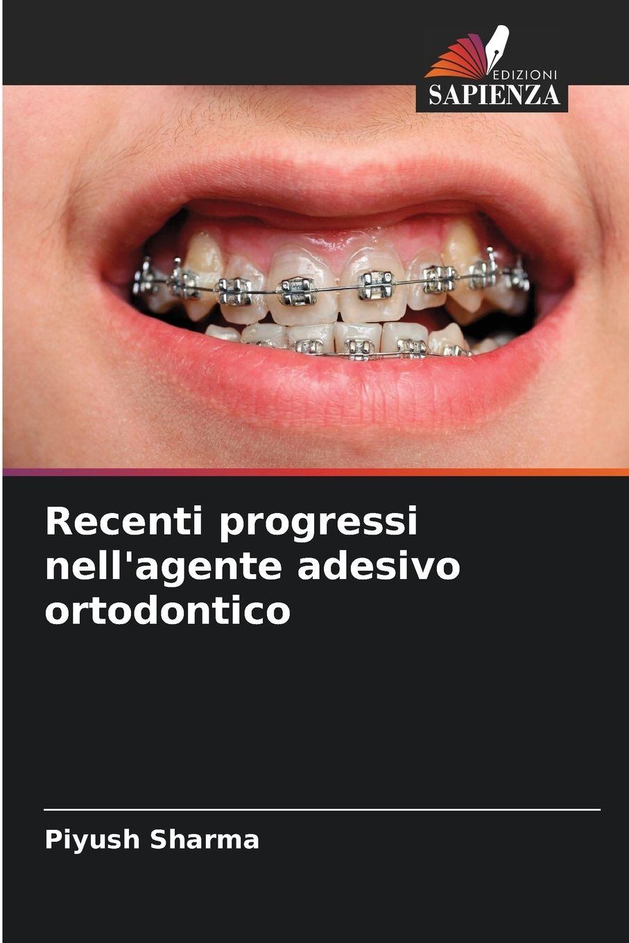 Vorderes Coverbild Recenti progressi nell'agente adesivo ortodontico