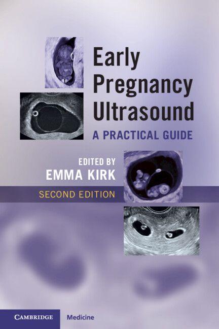 Vorderes Coverbild Early Pregnancy Ultrasound
