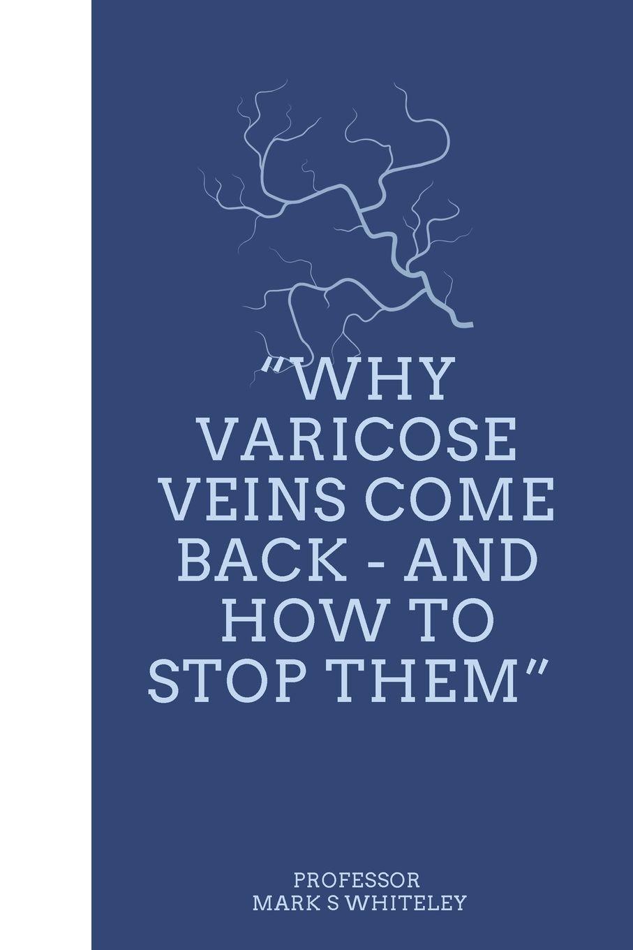Vorderes Coverbild Why Varicose Veins Come Back - and How to Stop Them