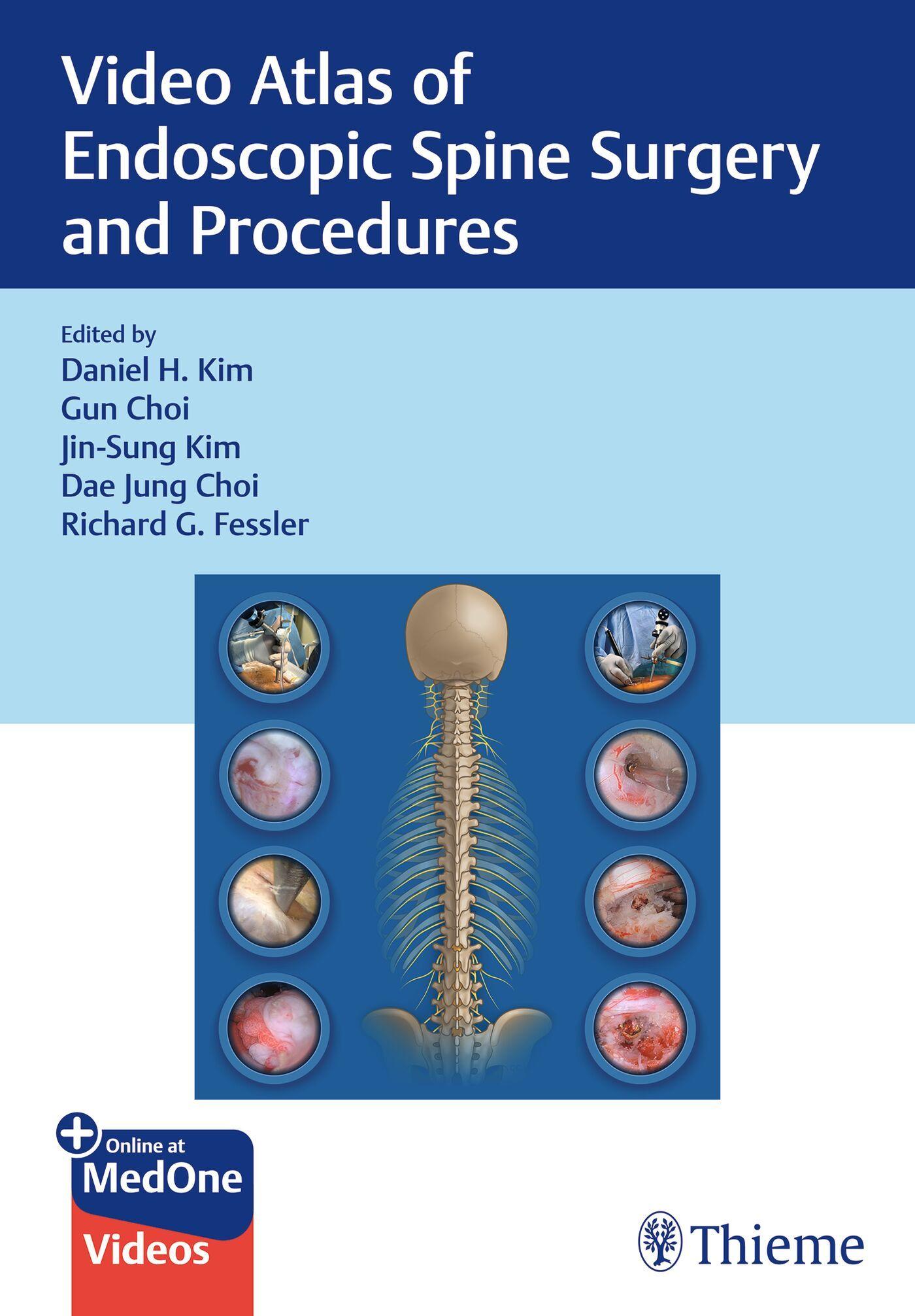 Vorderes Coverbild Video Atlas of Endoscopic Spine Surgery and Procedures