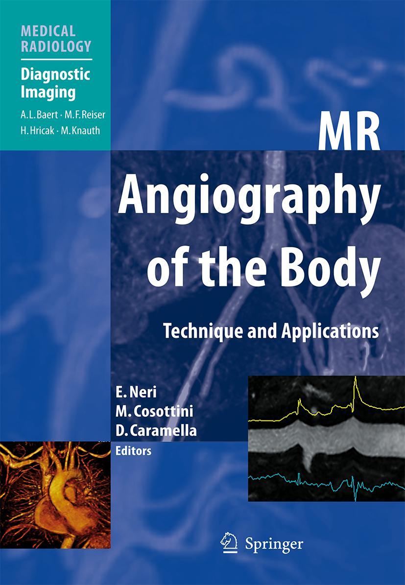 Vorderes Coverbild MR Angiography of the Body