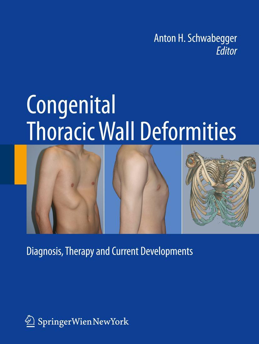 Vorderes Coverbild Congenital Thoracic Wall Deformities