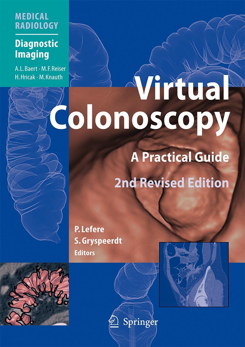 Vorderes Coverbild Virtual Colonoscopy