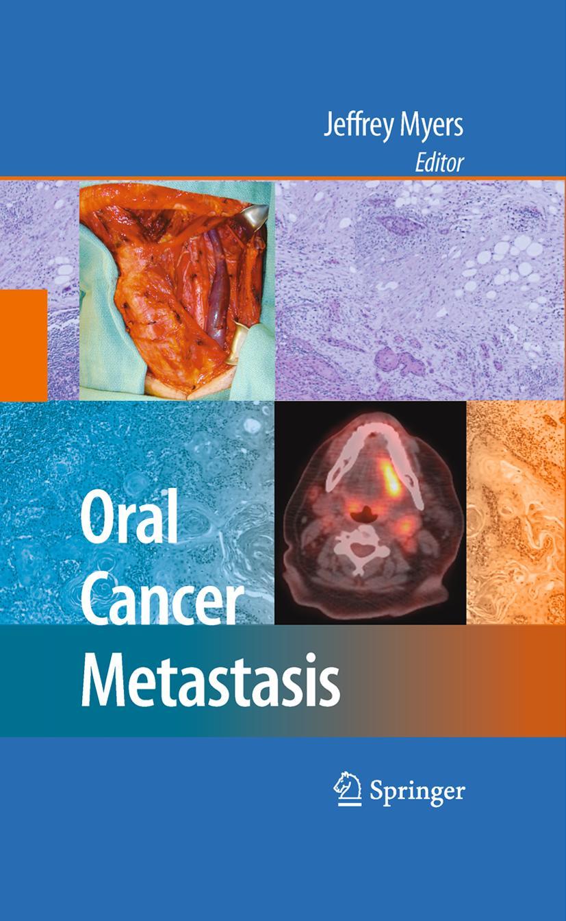 Vorderes Coverbild Oral Cancer Metastasis