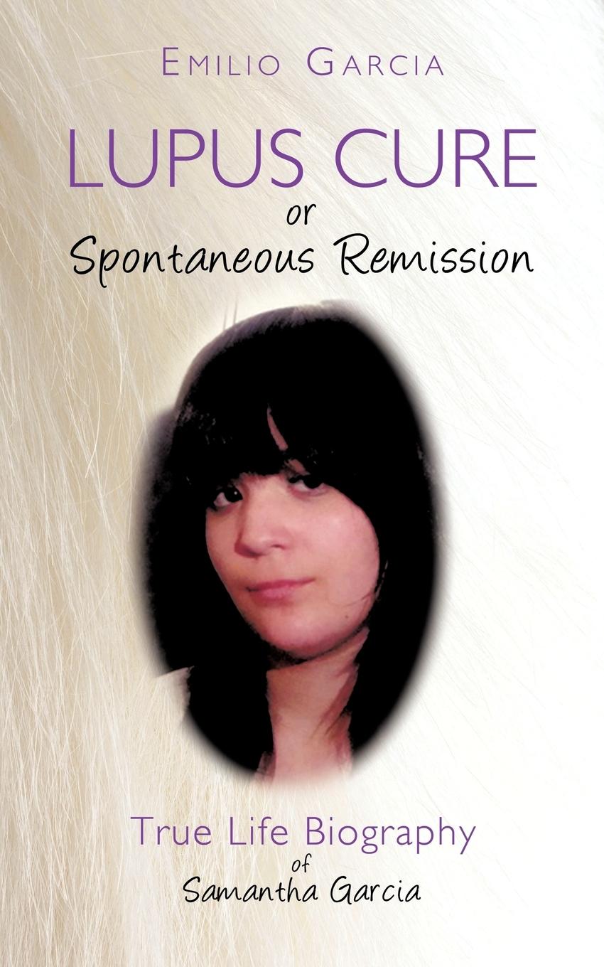 Vorderes Coverbild Lupus Cure or Spontaneous Remission