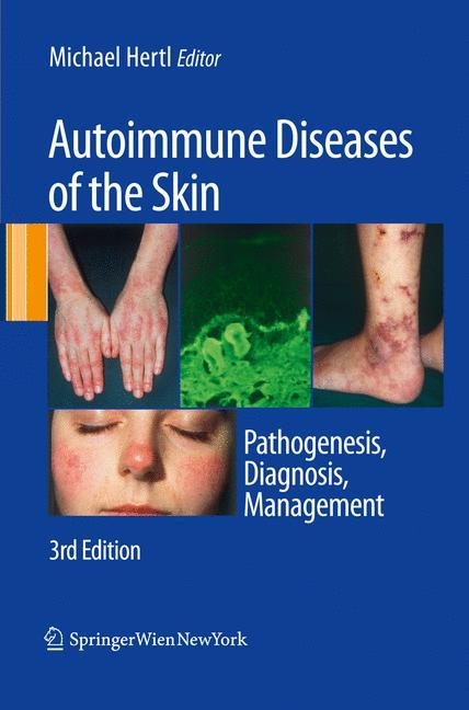 Vorderes Coverbild Autoimmune Diseases of the Skin